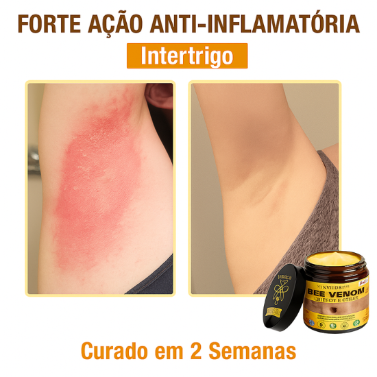 Creme Total com Veneno de Abelha