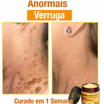 Creme Total com Veneno de Abelha