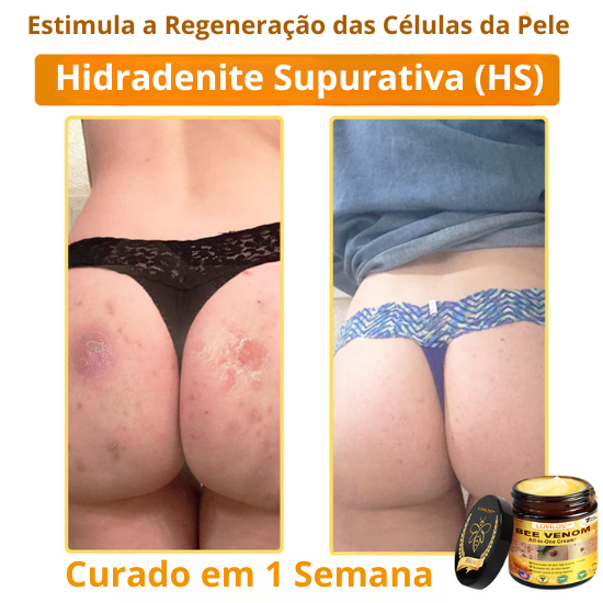Creme Total com Veneno de Abelha