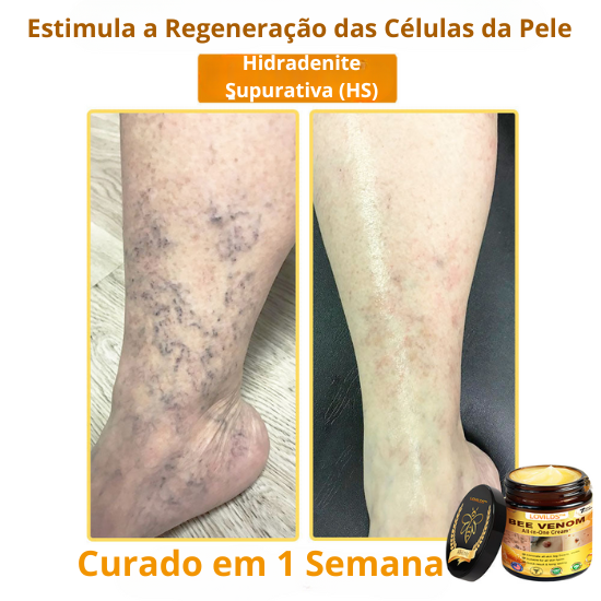Creme Total com Veneno de Abelha