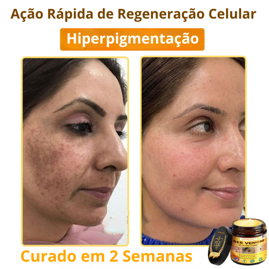 Creme Total com Veneno de Abelha