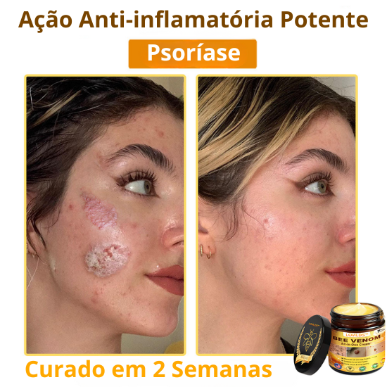 Creme Total com Veneno de Abelha