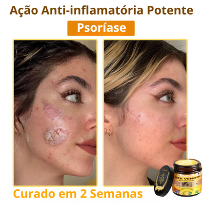 Creme Total com Veneno de Abelha