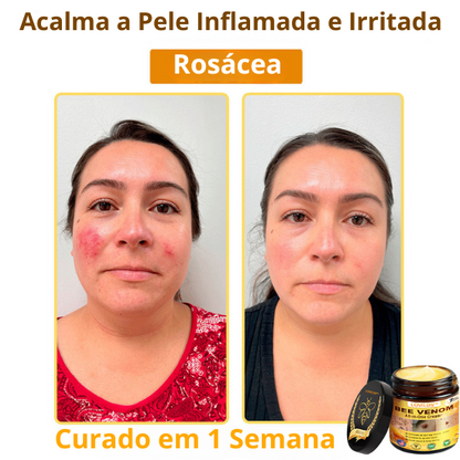 Creme Total com Veneno de Abelha
